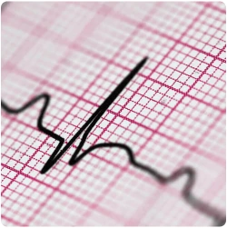 Eletrocardiograma